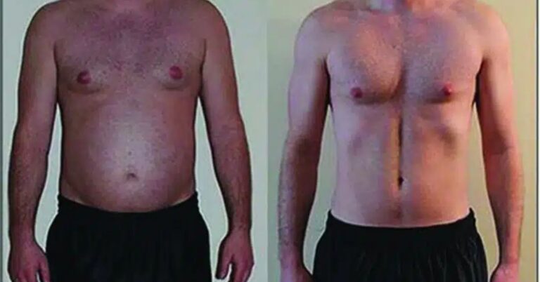 semaglutide before and after